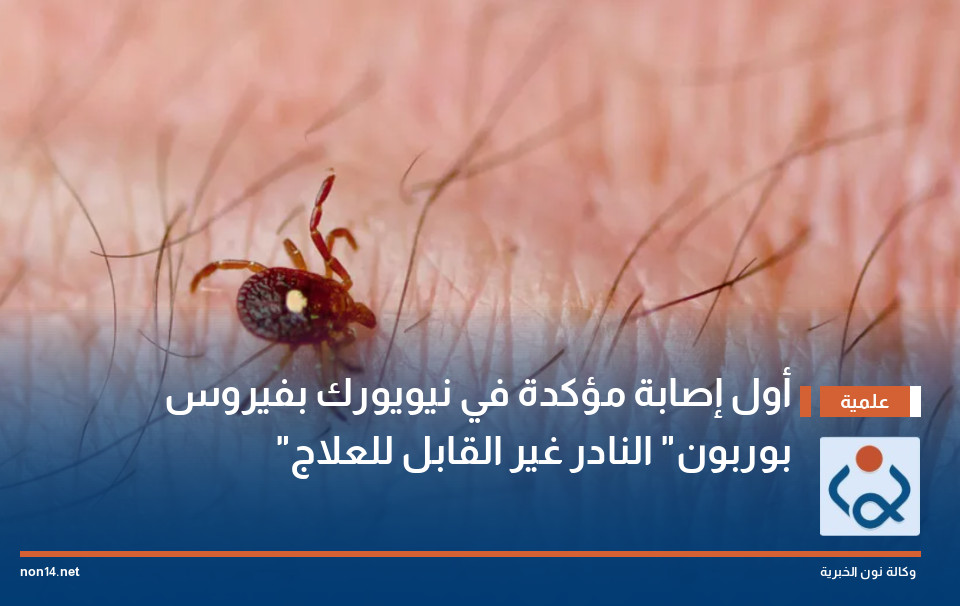 أول إصابة مؤكدة في نيويورك بفيروس "بوربون" النادر غير القابل للعلاج